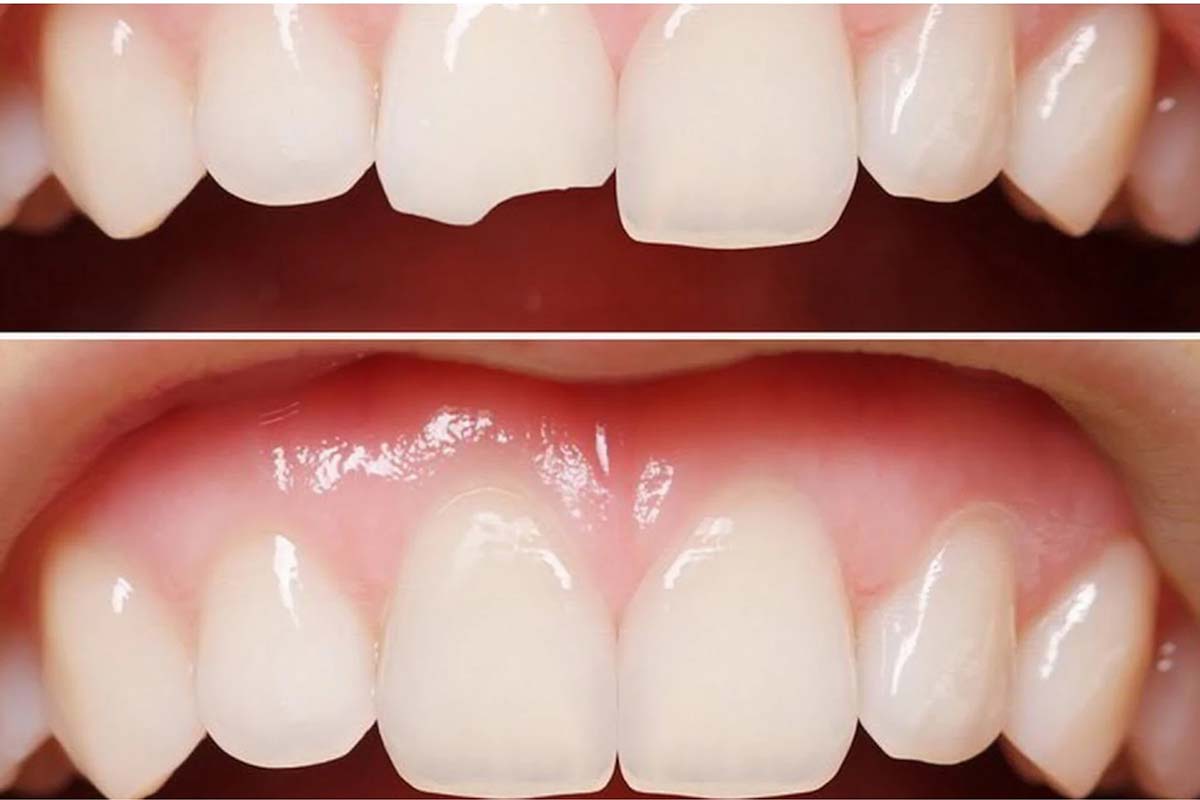 Lefkoşa Kompozit Lamina Banner